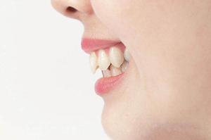 盛岡で四十肩を効果的に改善する最新対策法2026年版